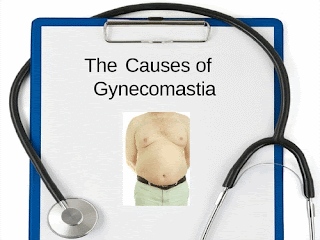 Gynecomastia Causes in Men