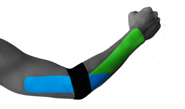 KinesioTaping_Lateral_Elbow_Pain3.png