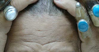 आम और खास की आम बीमारी-सिरदर्द