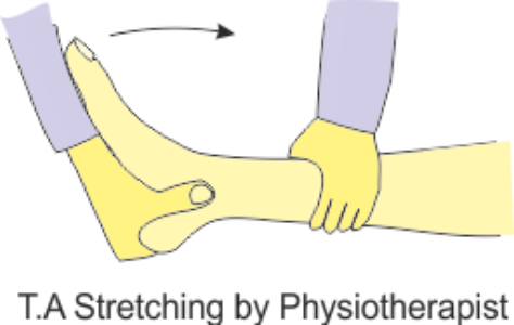 therapy ta retro calcaneal tendonitis calcification everything physiotherapy therapy ta retro calcaneal tendonitis calcification everything physiotherapy