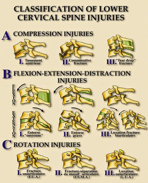 free types in compilation third international workshop tic 2000 montreal canada september 21 2000