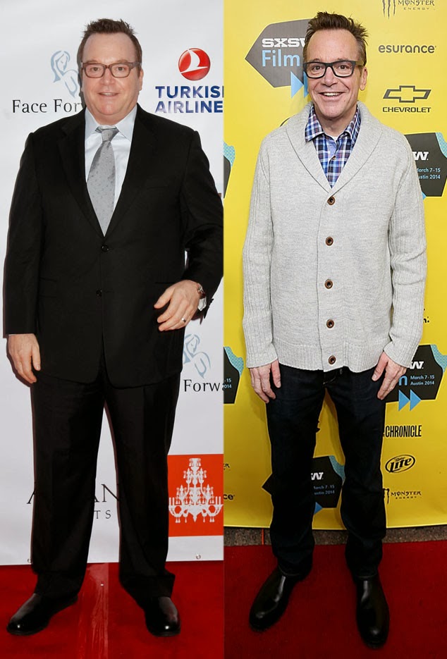 tom arnold pic tom arnold shows off extreme 89 pound weight loss at sxsw tom arnold pic tom arnold shows off extreme 89 pound weight loss at sxsw