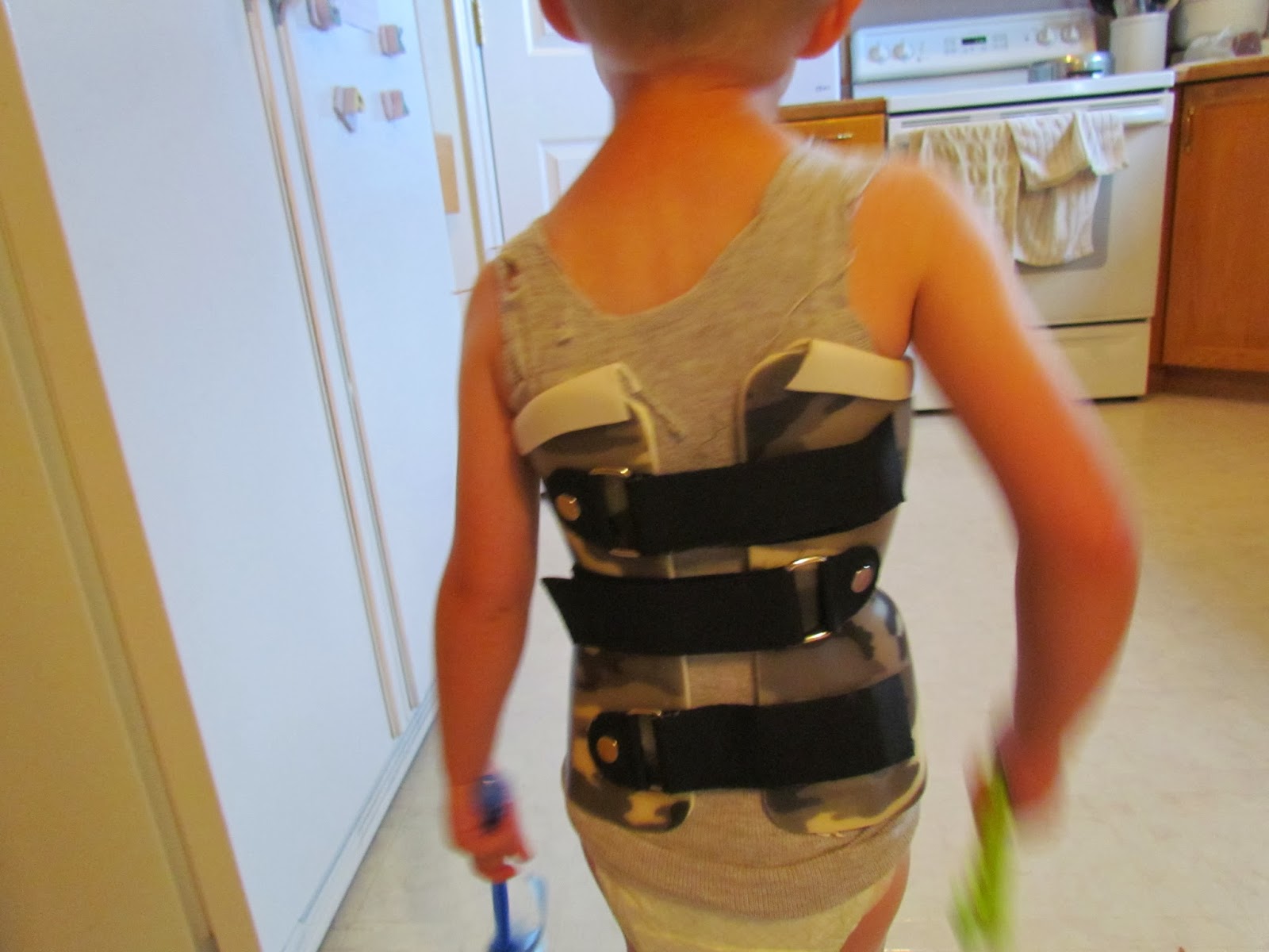 Our Journey through Progressive Infantile Scoliosis pictures of brace
