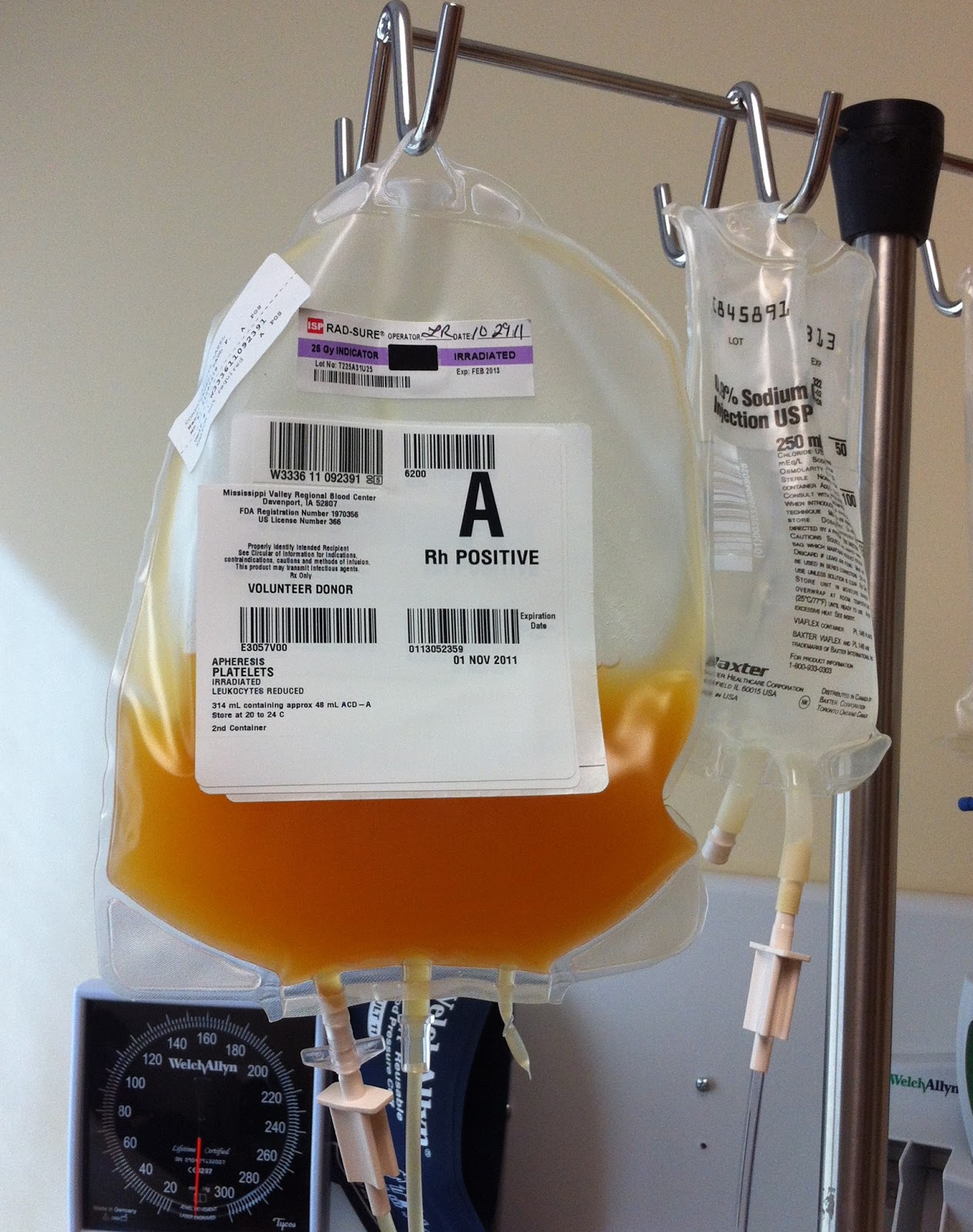 Bleeding from low platelets Pictures