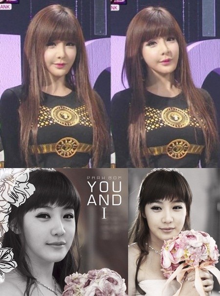 Park bom plastic surgery