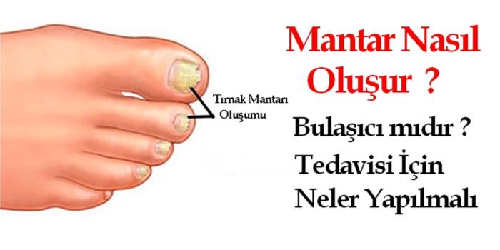 turkiye nin en iyi moda blogu tirnak mantari