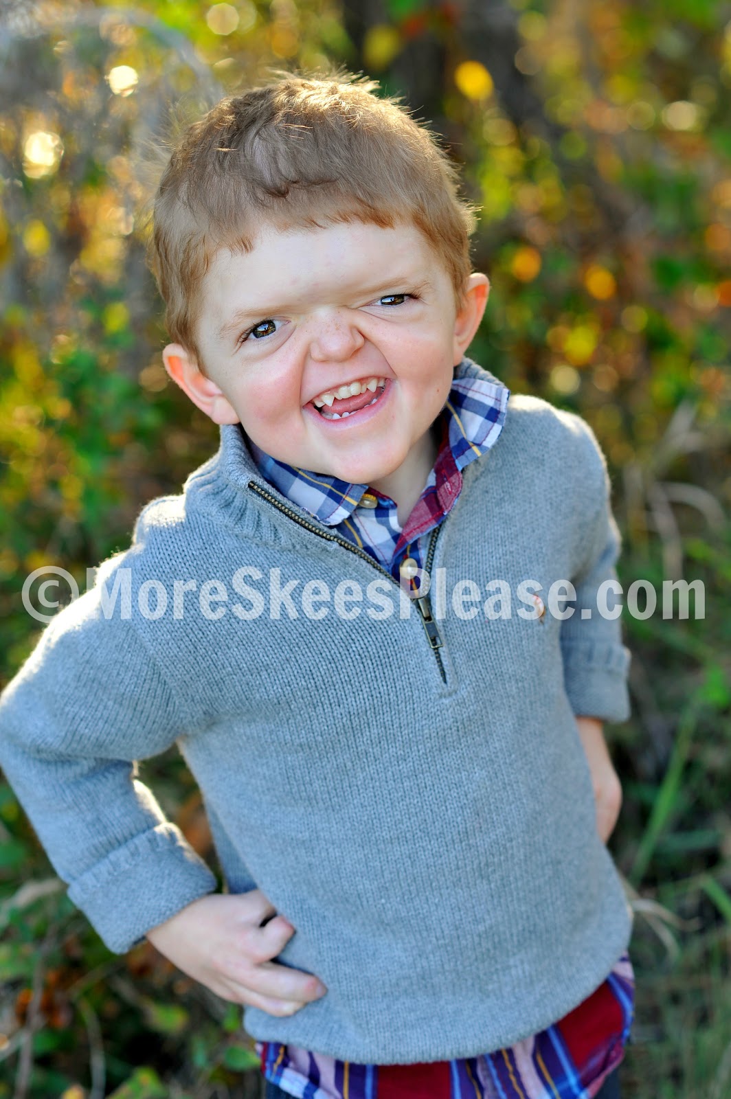 Our Amazing Aiden: An Update