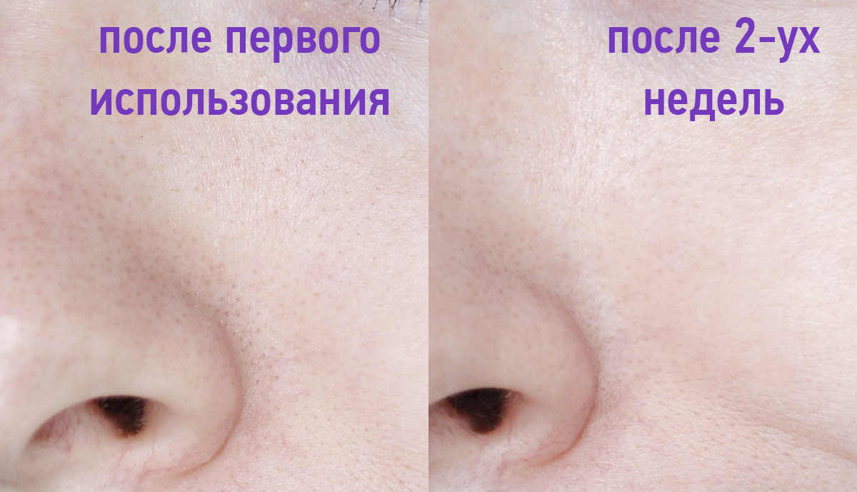 Девушка из Дании (2015) смотреть онлайн бесплатно Гингивит у кошек: причины, симптомы, лечение и предупреждение