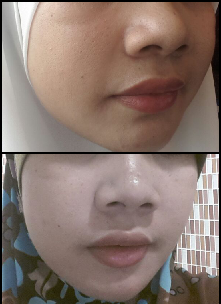 secret skin secret skin white kawaii collagen by nadialiyana all secret skin secret skin white kawaii collagen by nadialiyana all