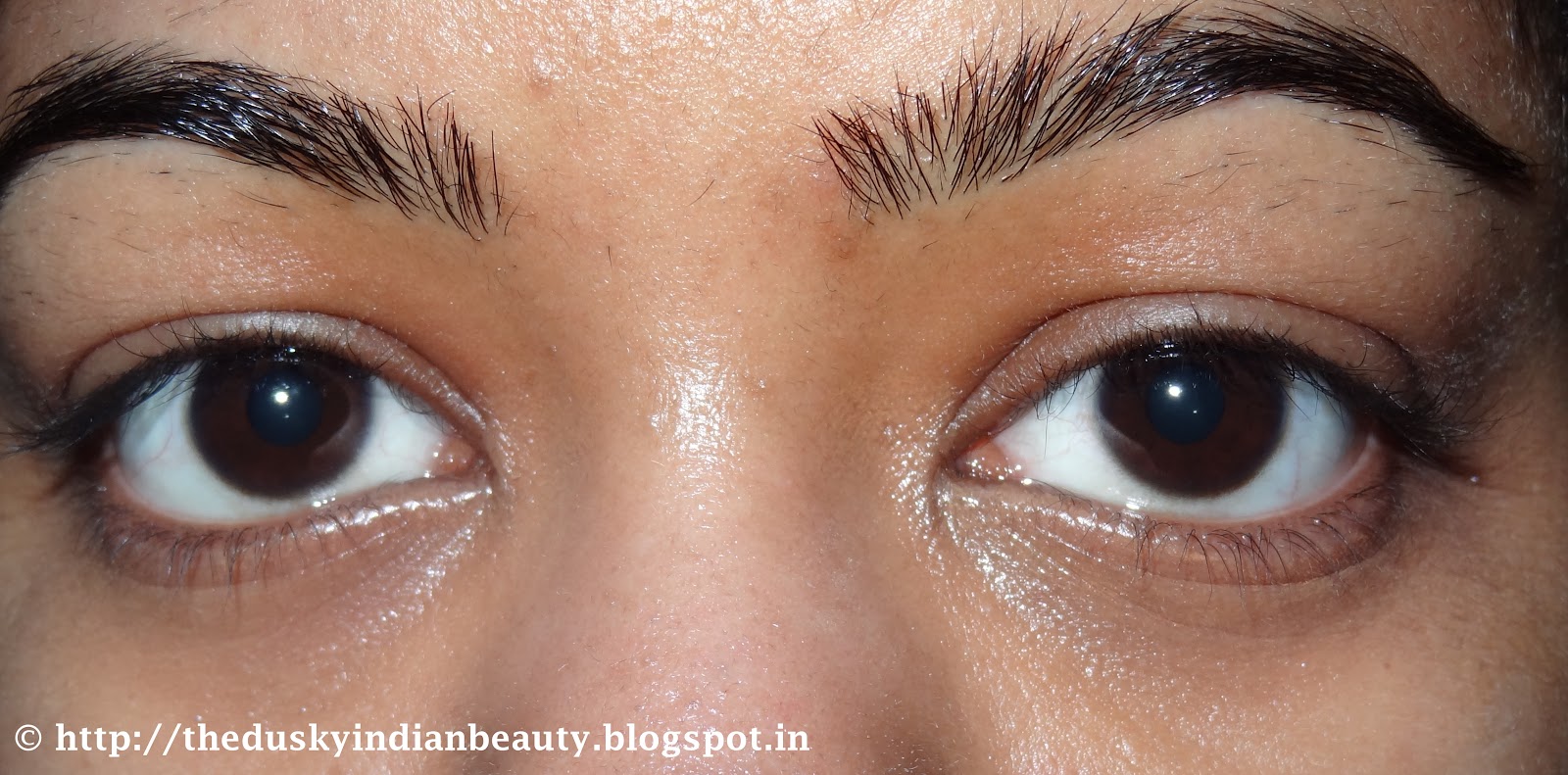 [Antiaging] Expression lines under eye r/SkincareAddiction