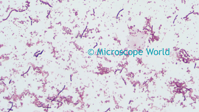 Gram stain of 3 types of bacteria captured under RB30 biological microscope at 400x.