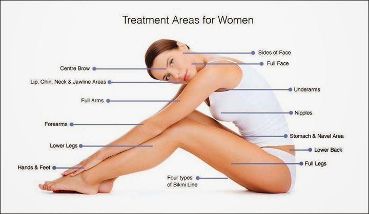 Laser Hair Removal Treatment Areas for Women