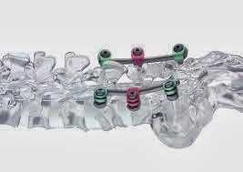 krypton www.thespinemarketgroup.com