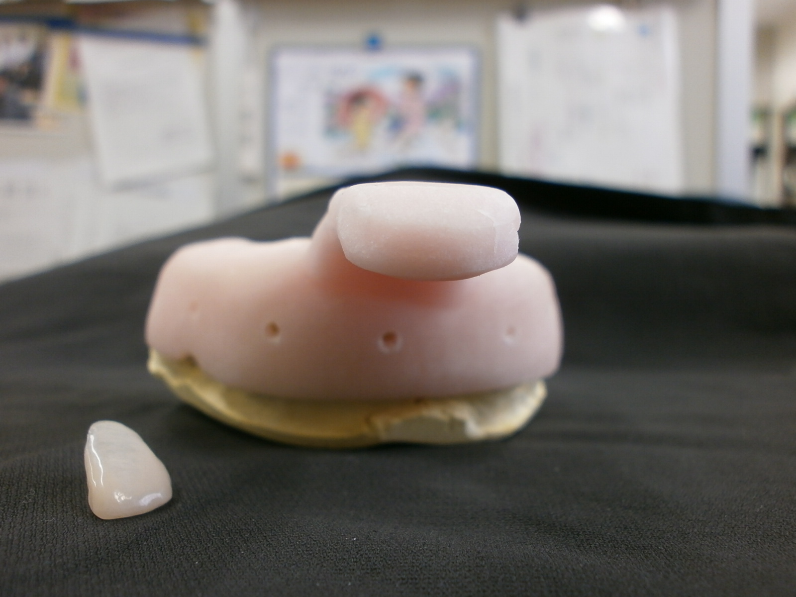 テーラーメイド歯科補綴修復物の紹介 Introduction Of The Tailor Maid Dental Prosthesis 個人トレー 個歯トレー テンポラリークラウン 上顎左側中切歯 Custom Tray For A Crown Abutment Tray And Temporary Crown