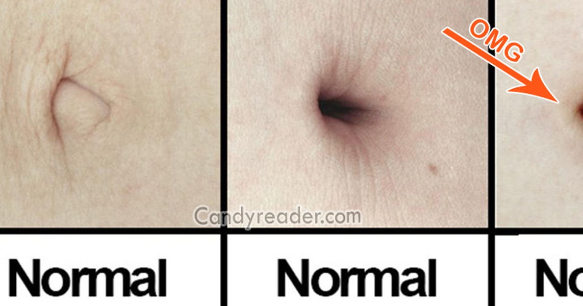 OMG! 10 Bizarre Facts About Belly Button You Cannot Even Imagine The