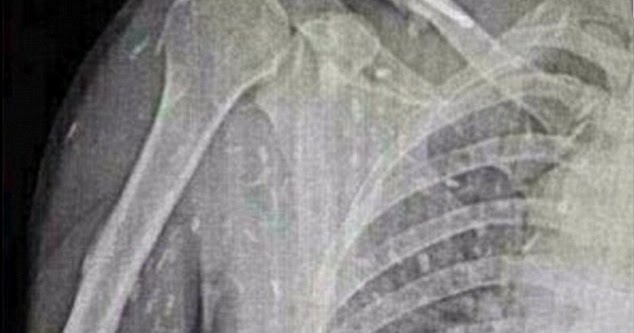 See Here: 7 Most Shocking Parasites Ever Found Living Inside The Human