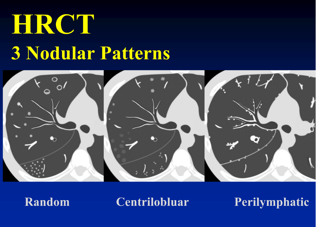 thin section ct vs hrct