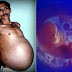 Indian man Gets pregnant