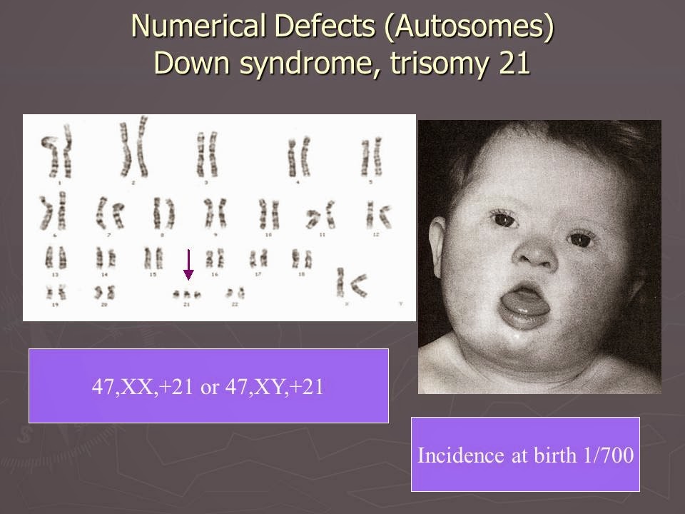 Slide 13