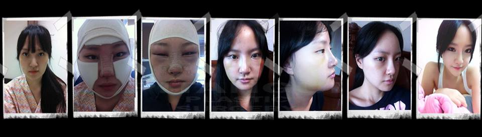 Корея косметические операции женщины до и после Ответы : Почему женщины так прекрасныЯ не смогла ответить...помогите