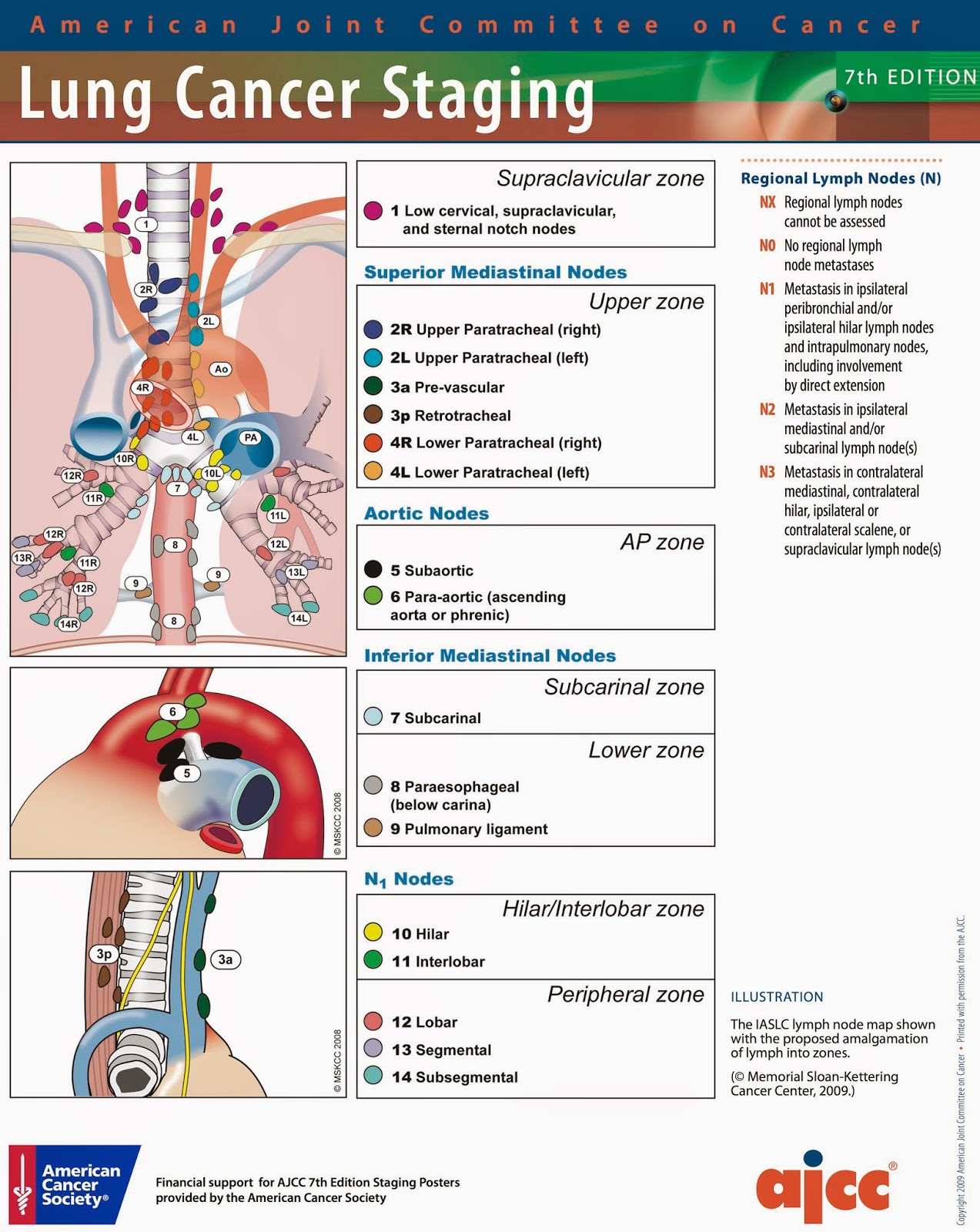 cancer in lymph nodes