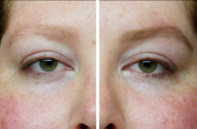 Watch How To Do Eyebrow Slits video Watch How To Do Eyebrow Slits video