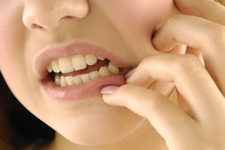 10 Cara Mengobati Sakit Gigi yang Berlubang