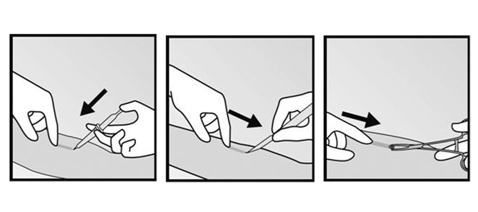 My Experience With Nexplanon Gina Faria Beauty, Fashion, Makeup