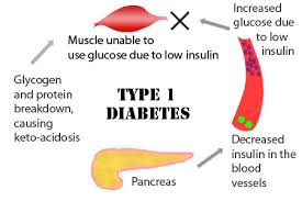Obat Penyakit Diabetes Yang Ampuh