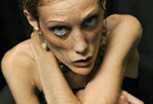 Ορμόνη μπορεί να βοηθήσει τη νευρογενή ανορεξία