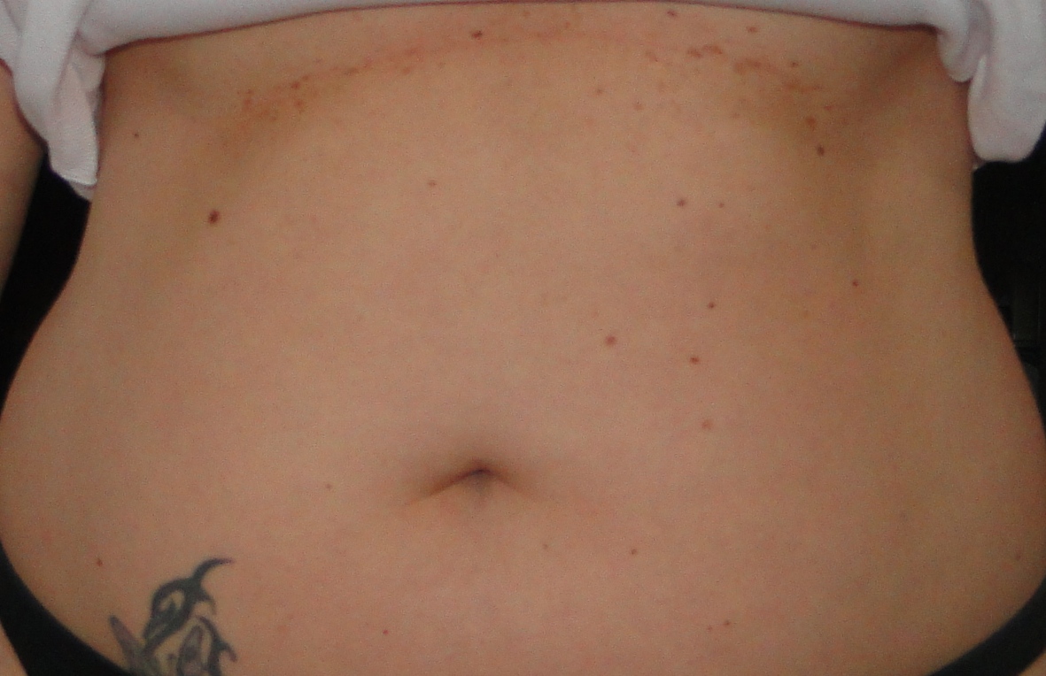 Bisa Lurdes: Dezembro 2011