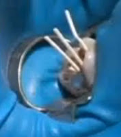 Root canal essay 04 image