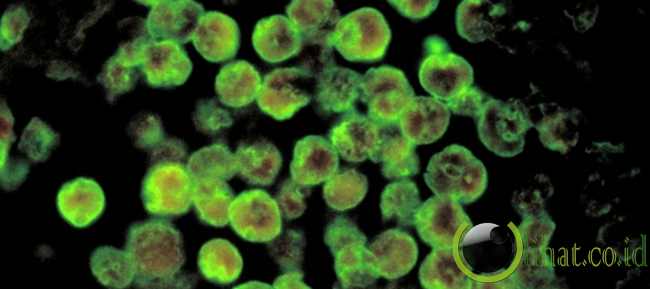 Naegleria fowleri Naegleria fowleri