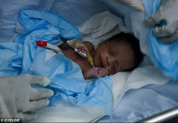 Bayi yang selamat saat gempa bumi dan bayi itu terkubur oleh reruntuhan bangunan