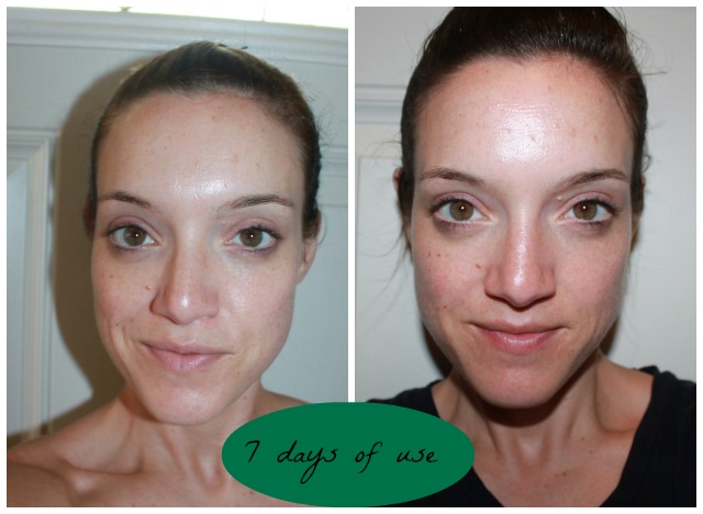 Product Review Jan Marini Five Step Skin Care Management System Balancing Lisa