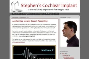 Stephen's Cochlear Implant