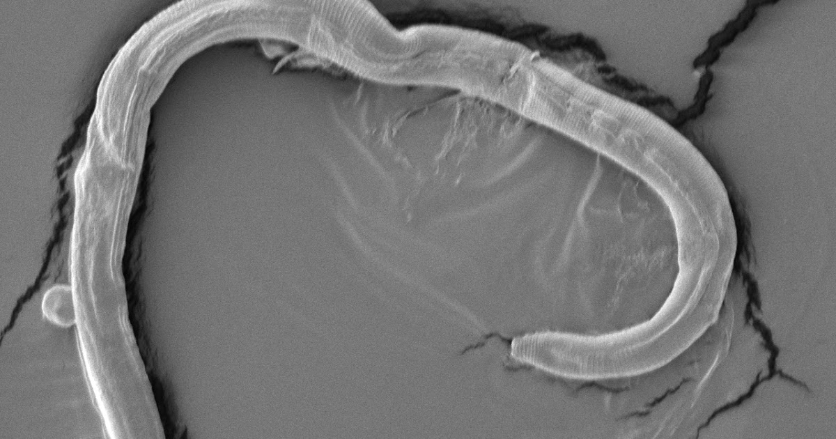 nematode under electron microscope All about plant