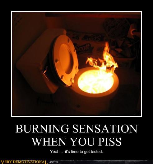 burns to pee Locker room nude pics