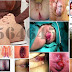 Obat Tradisional Hemoroid (Wasir) BPOM thumbnail