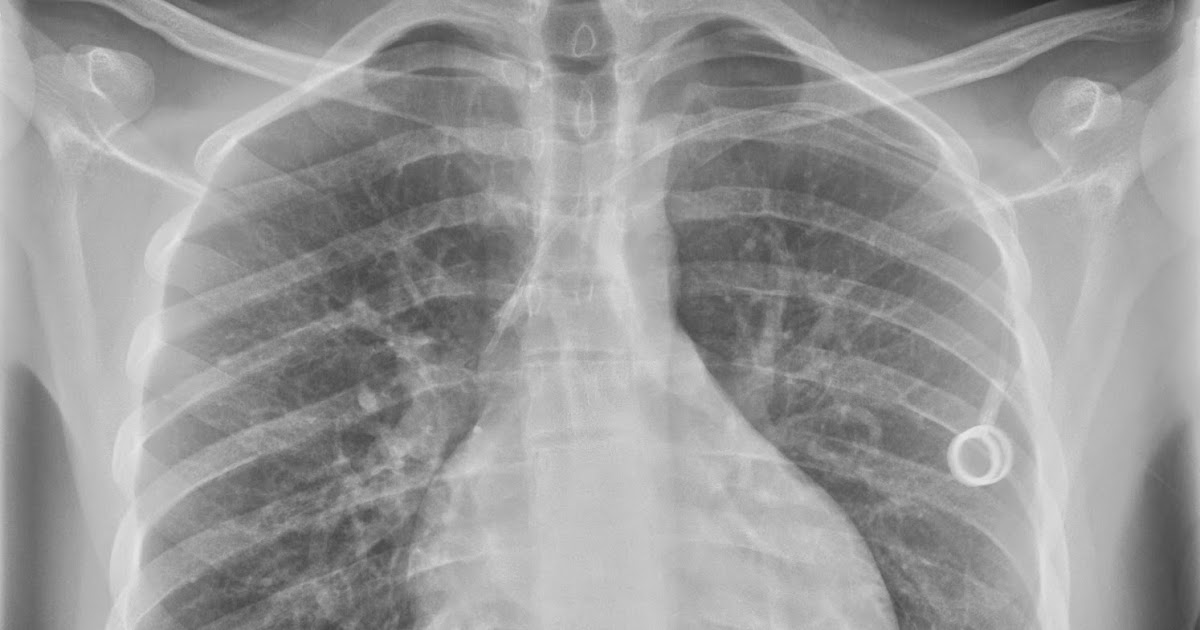 the xray doctor A classic radiology case...