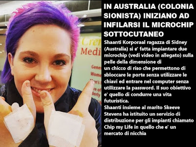 Risultati immagini per microchip australia