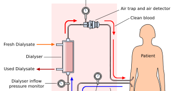 dialysis