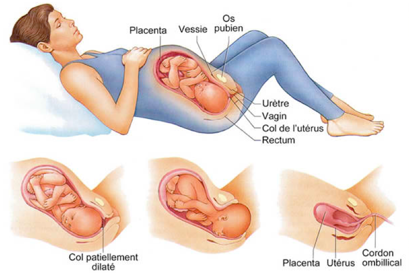 empecher la rencontre des cellules reproductrices