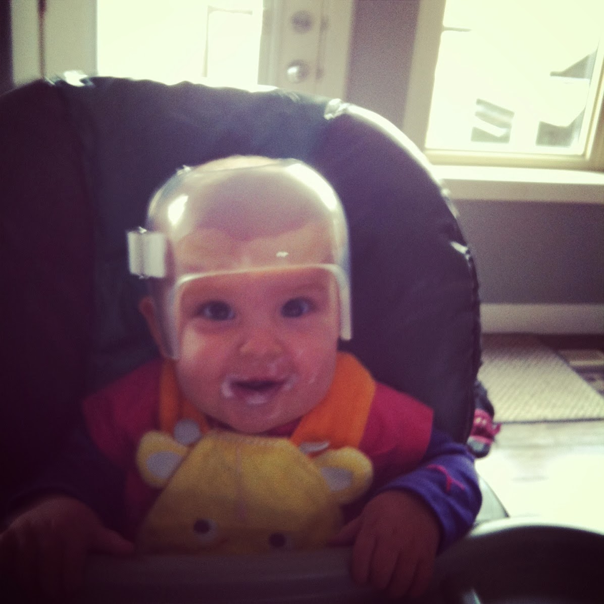 Helmet Use For Plagiocephaly