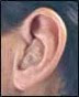 Hearing Aids