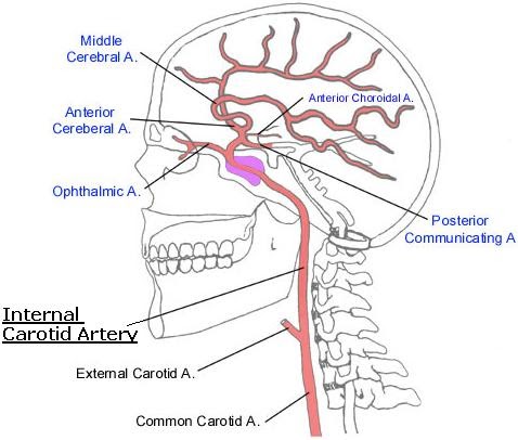 Internal Carotid Artery