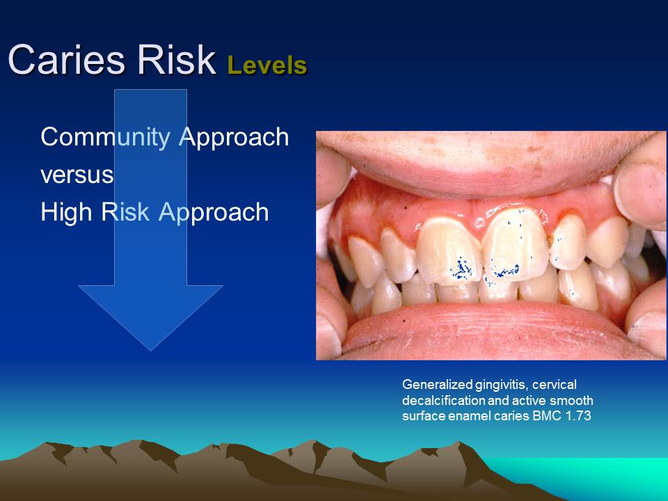 Dentistry Caries Risk Assessment