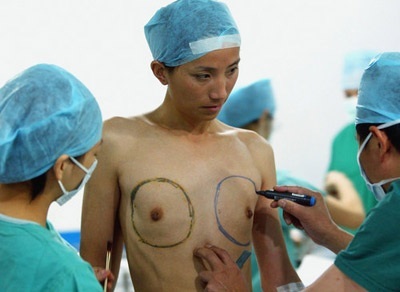 Las muchachas jóvenes con el pecho de silicio