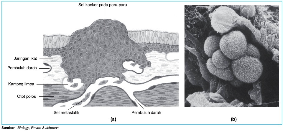 Contoh Mutasi Gen dan Kromosom pada Manusia Mekanisme