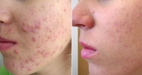 Comment enlever les taches noir Au-dessus des radiateurs ?